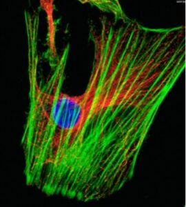 Contaminated HeLa Cells